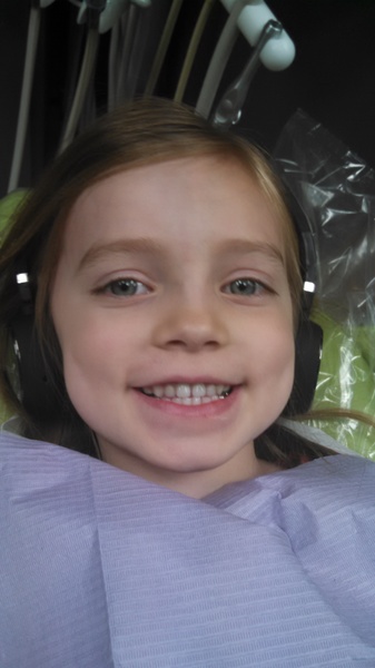Goodbye Front Teeth