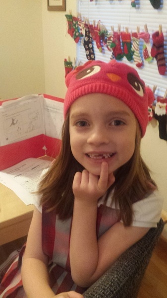 Lost Tooth