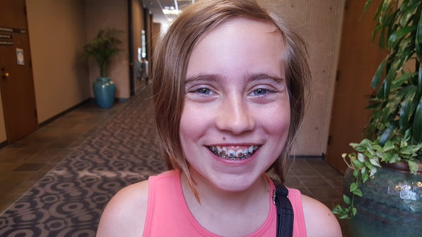 New Braces