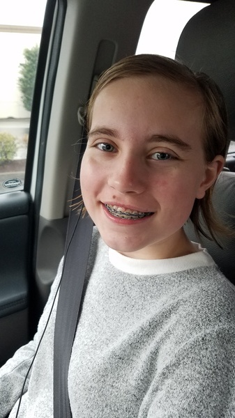Last Day with Braces