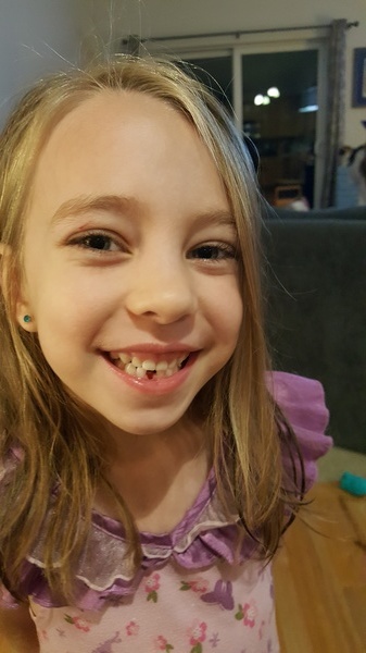 Lost Tooth