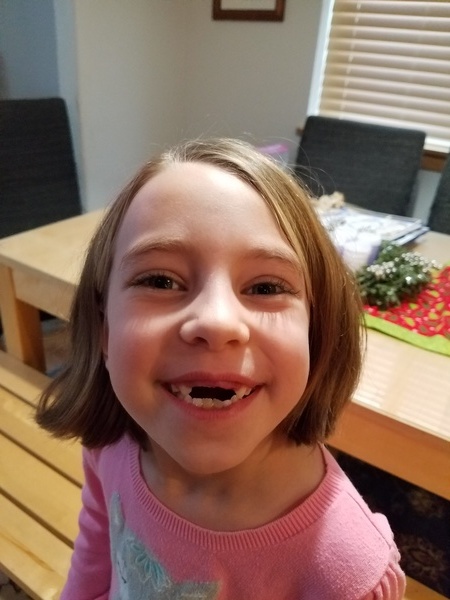 All I Want for Christmas is My Two Front Teeth